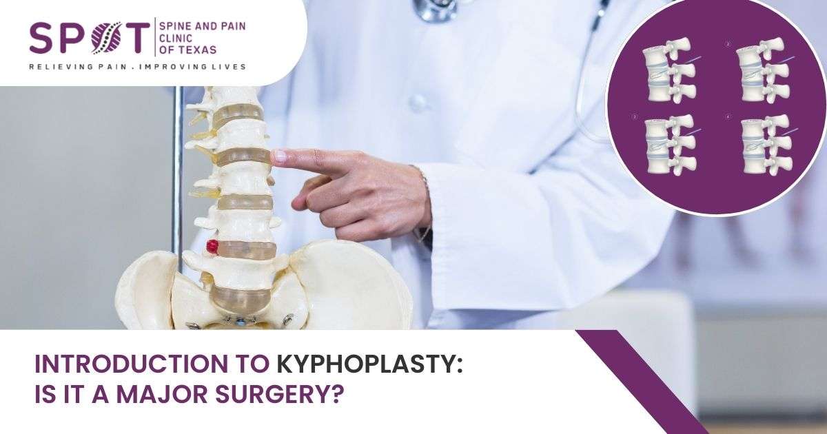 Introduction to Kyphoplasty