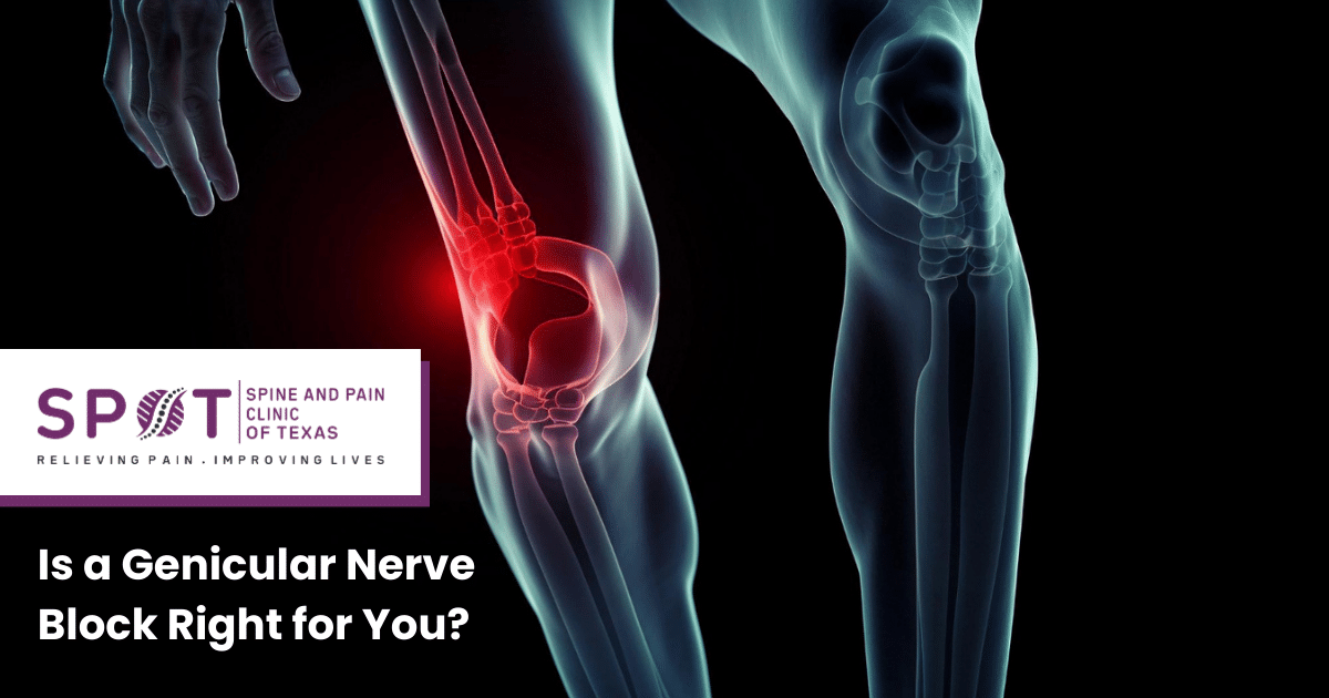Is a Genicular Nerve Block Right for You