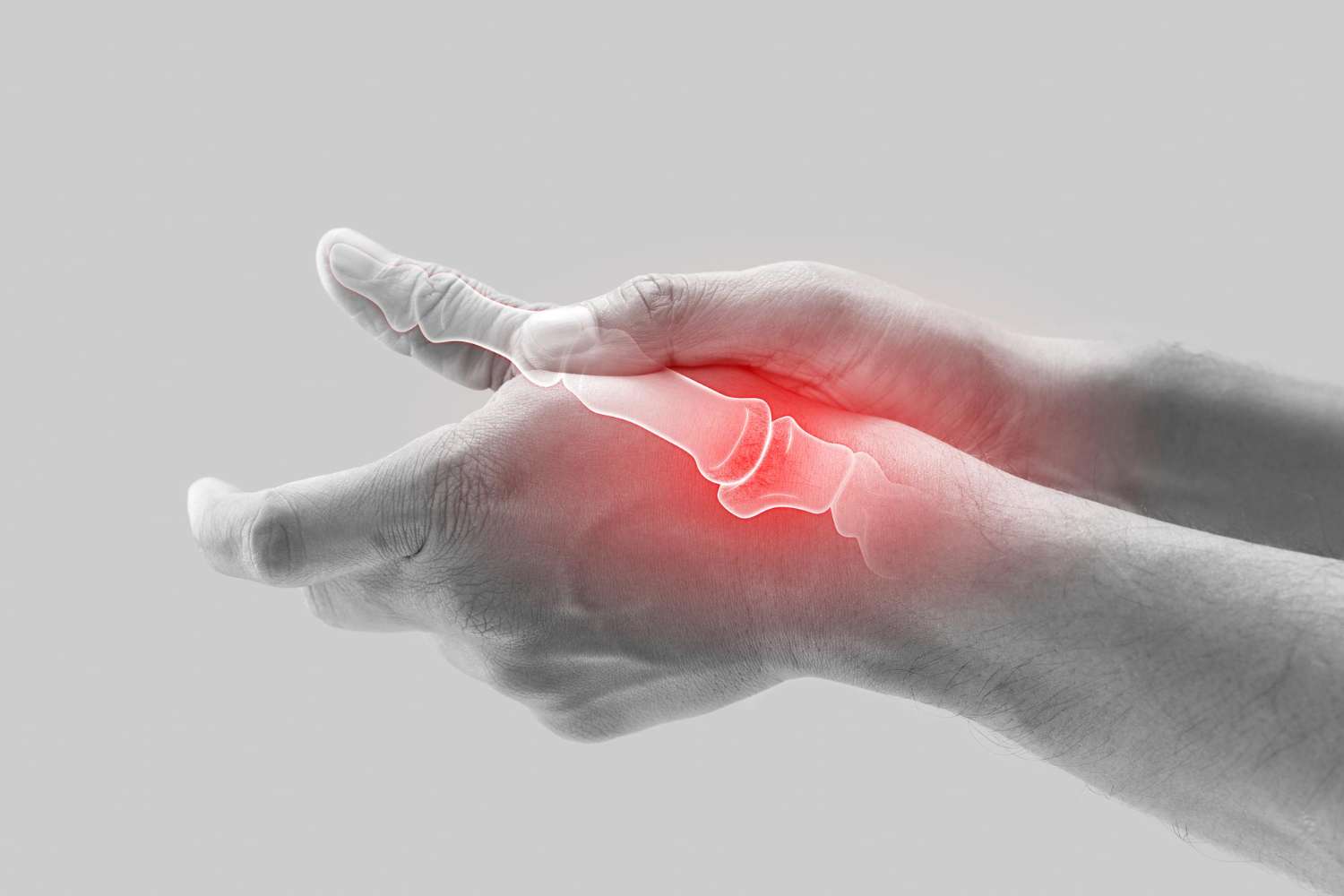 What is Osteoarthritis OA