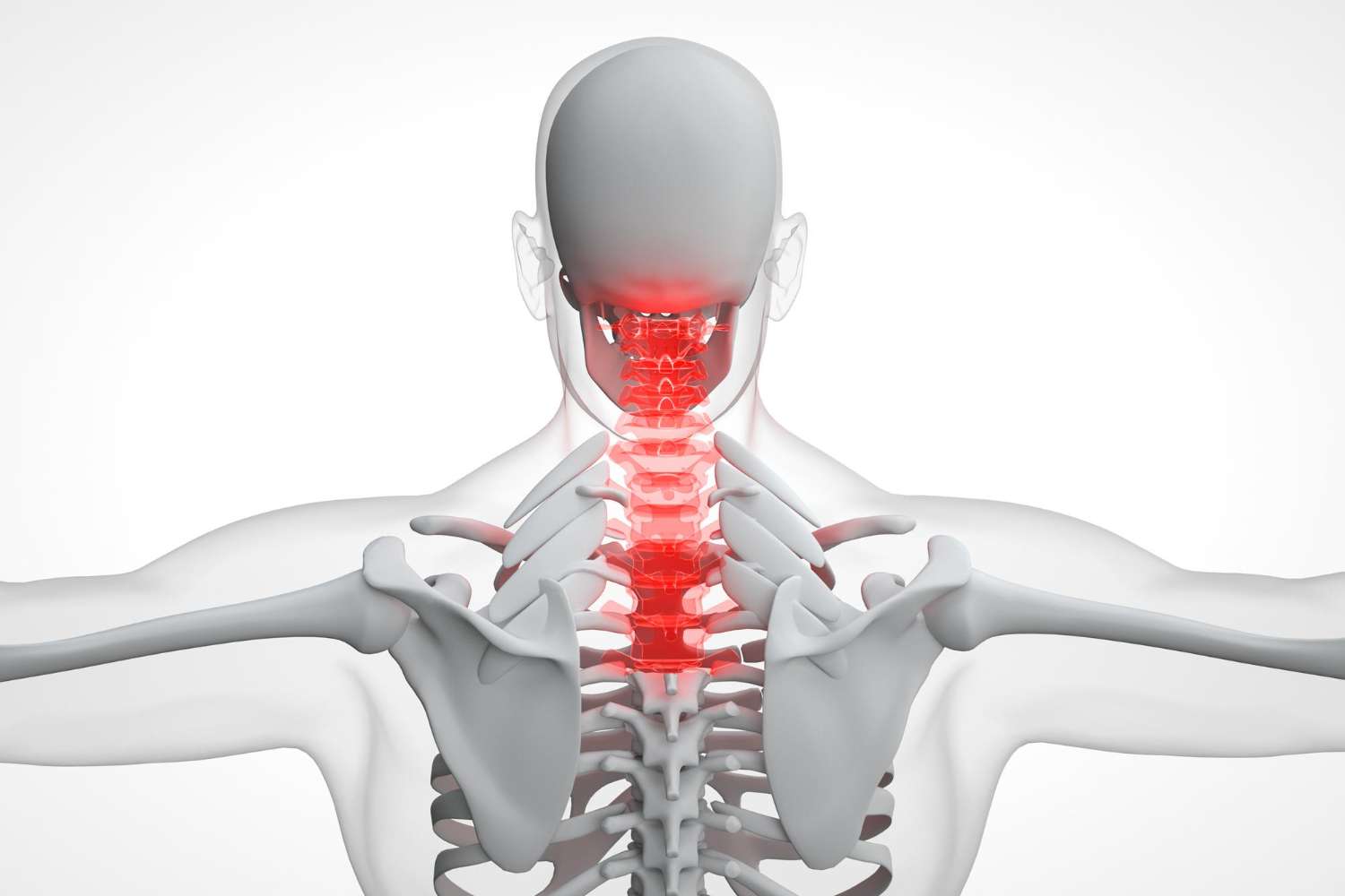 Misalignment Of Cervical Spine Symptoms and Treatment Options