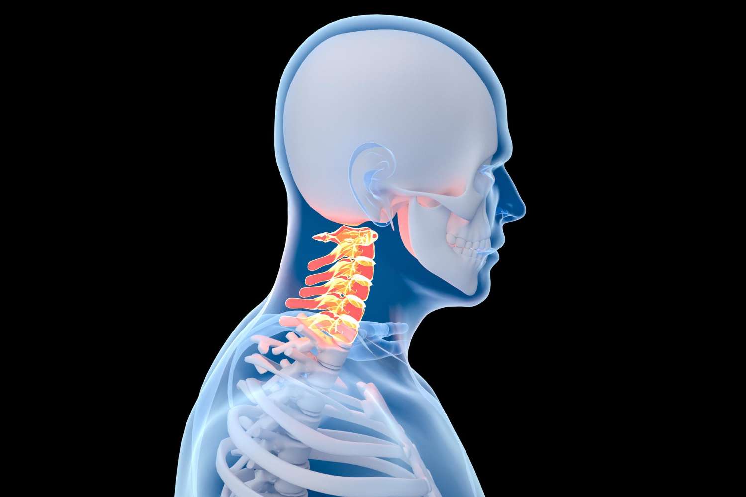 How to Relieve Cervical Spine Pain