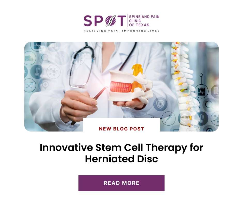 Stem Cell Therapy for Herniated Disc
