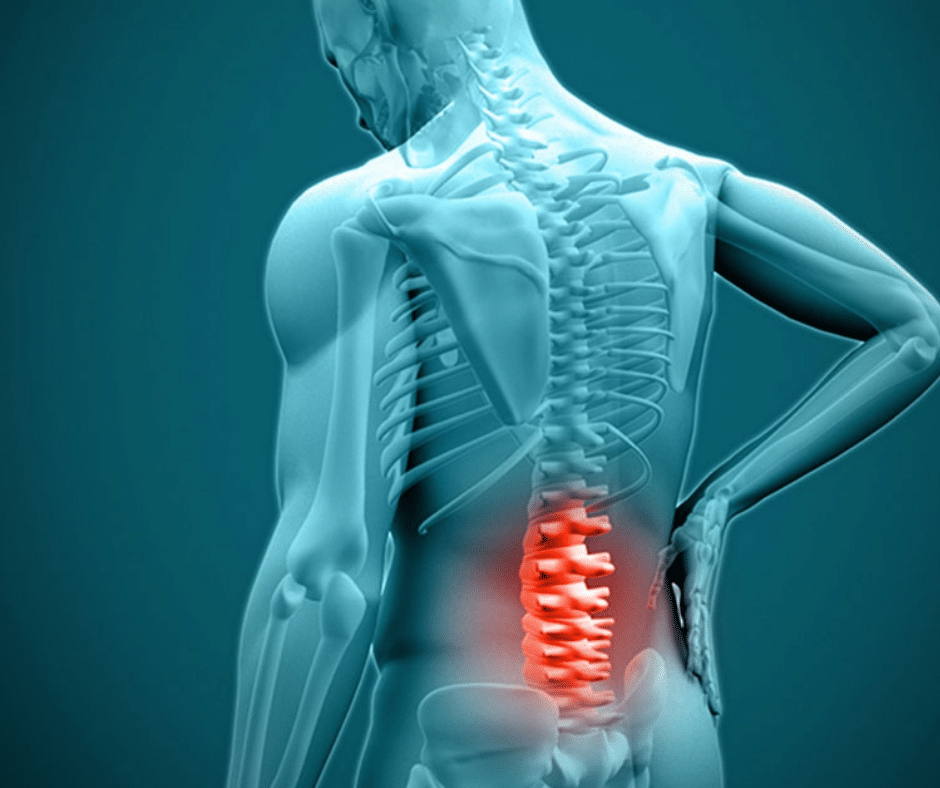 Minimally Invasive Lumbar Decompression
