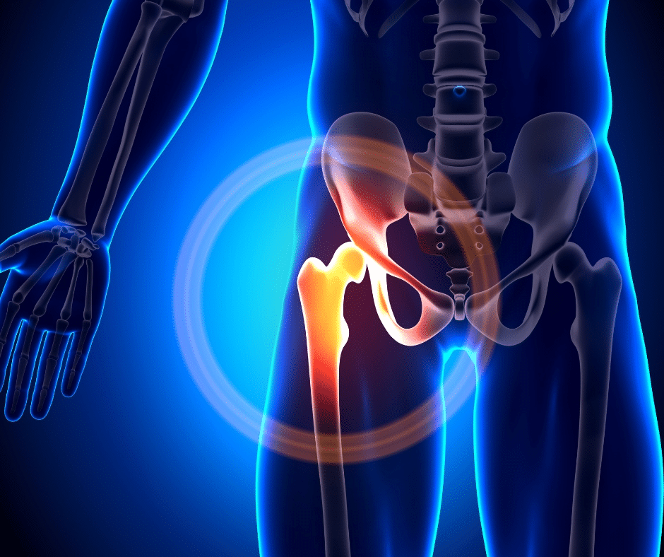 Types of Hip Injections